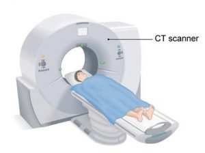 IFRS 16 Right to use